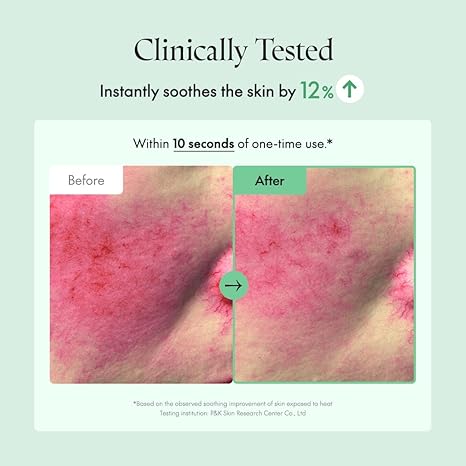 Before and after comparison of skin Purito sootihing redness Paphos Cyprus