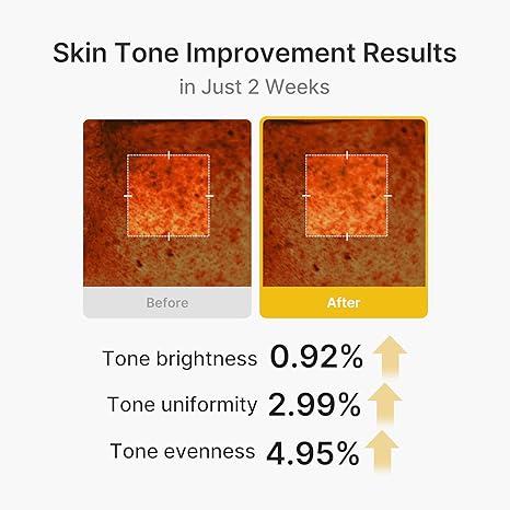 Even skin tone and radiant glow with Medicube Kojic Acid Capsule Cream – brightening Korean skincare 