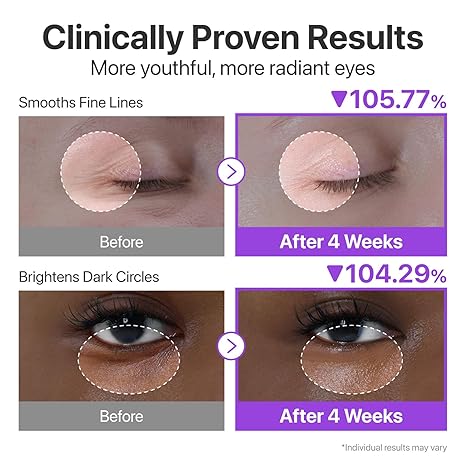 Numbuzin No.9 NAD Retinol Volumetox Eye Cream fine lines firmness brightening retinol NAD+ Cyprus