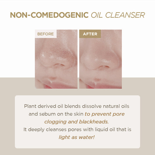 SKIN1004 Centella Light Cleansing Oil non-comedogenic before and after pore cleansing - Korean cosmetics Cyprus