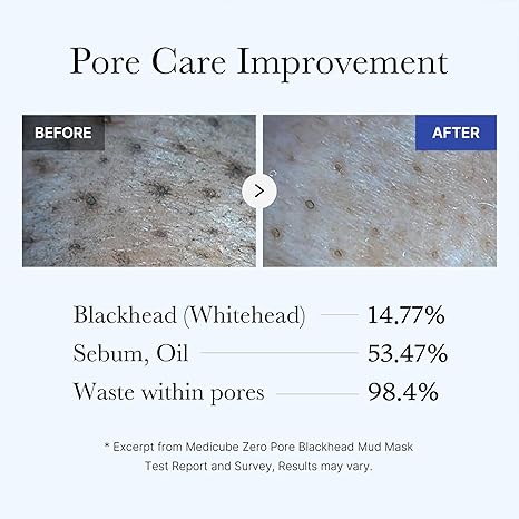 Medicube Zero Pore Blackhead Mud Mask pore cleansing blackhead removal deep cleanse Cyprus