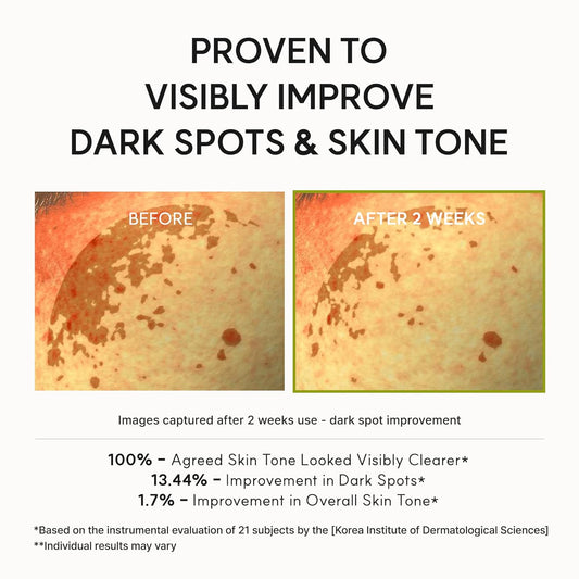 Arencia Vitamin C Booster Shot Serum with Glutathione and Niacinamide – glass skin serum Cyprus