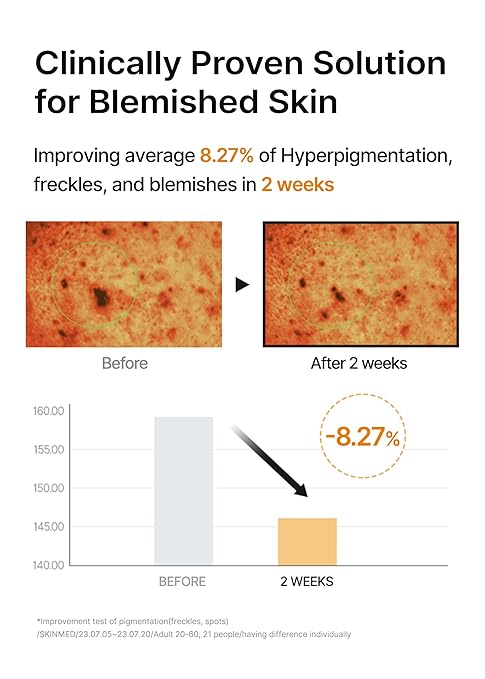 Celimax Pore Dark Spot Brightening Pad toner pads dark spots uneven skin tone pores Cyprus