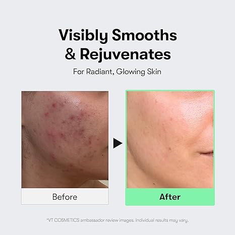 VT Cosmetics Reedle Shot 300 micro-spicule skin renewal firming texture Cyprus