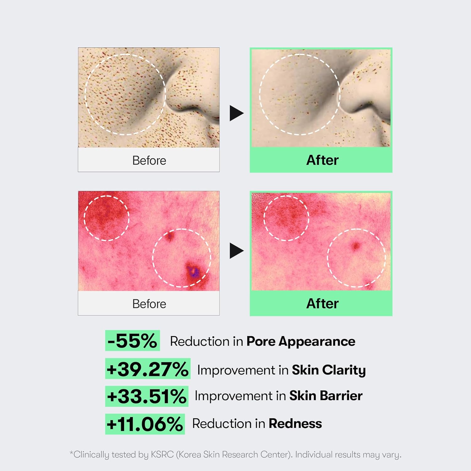 VT Cosmetics Reedle Shot 300 micro-spicule skin renewal firming texture Cyprus